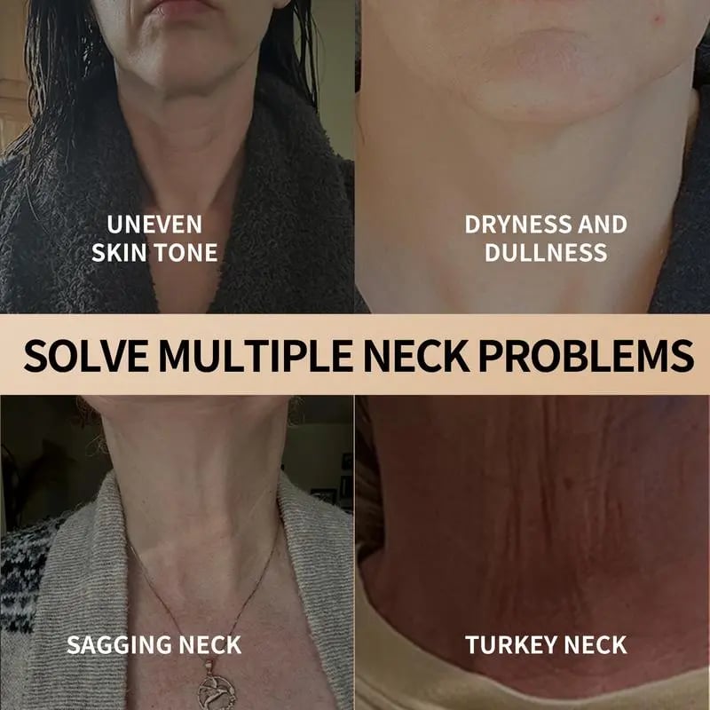 🔥Last Day 49% OFF - Tighten and Lift Neck Cream for Crepey Skin, Skin Moisturizer
